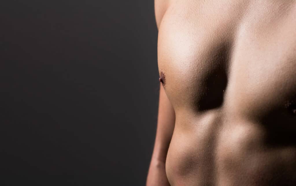 Fettabsaugung für Männer, z. B. zur Korrektur der Männerbrust