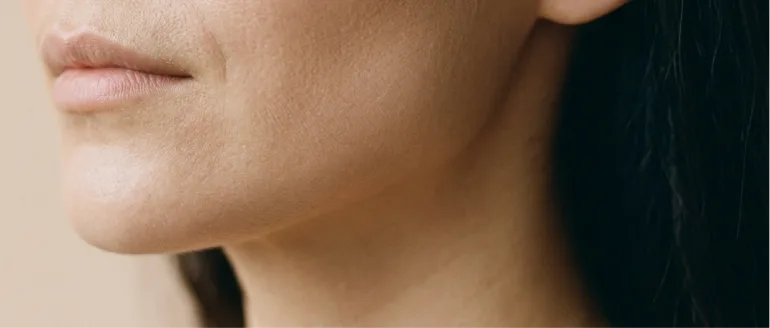 Dermafiller/Hyaluronsäure in München