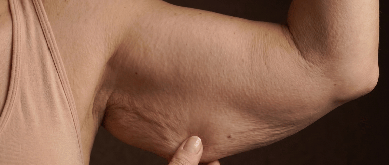 Nahaufnahme Arm einer Frau.